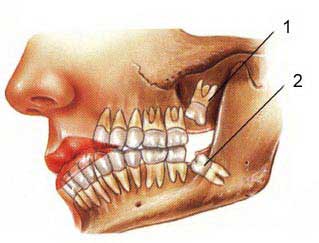 Oral & Maxillofacial