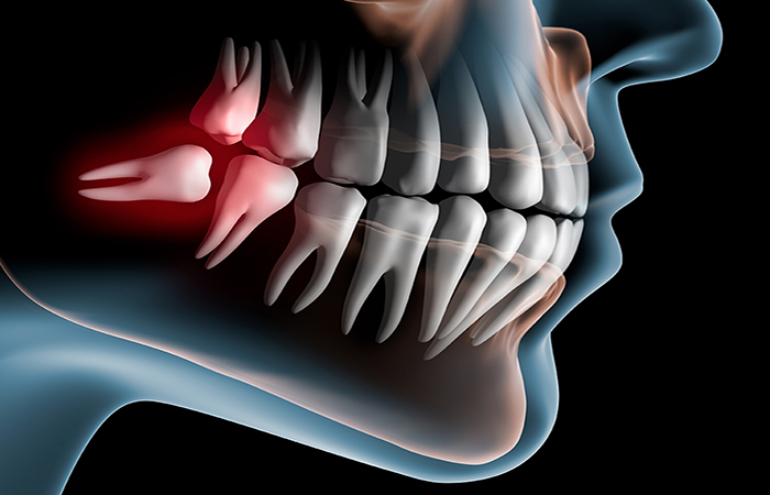 Oral & Maxillofacial Surgeon